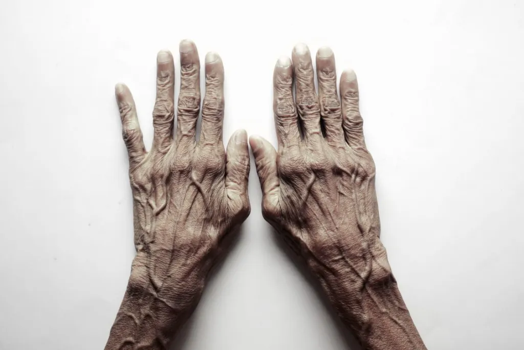 Mãos de pessoa idosa em imagem ilustrativa